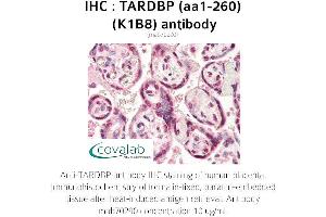 Image no. 1 for anti-TAR DNA Binding Protein (TARDBP) (AA 1-260) antibody (ABIN1723216) (TARDBP antibody  (AA 1-260))