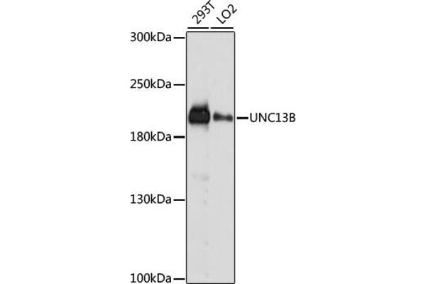 UNC13B 抗体  (AA 1-350)
