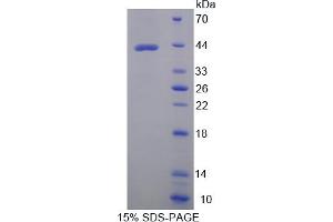 SDS-PAGE analysis of Human AST2 Protein. (GOT2 Protein)