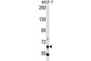 Western Blotting (WB) image for anti-phosphoenolpyruvate Carboxykinase 1 (Soluble) (PCK1) antibody (ABIN3003679)