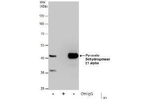 IP Image Immunoprecipitation of Pyruvate Dehydrogenase E1 alpha protein from HepG2 whole cell extracts using 5 μg of Pyruvate Dehydrogenase E1 alpha antibody, Western blot analysis was performed using Pyruvate Dehydrogenase E1 alpha antibody, EasyBlot anti-Rabbit IgG  was used as a secondary reagent. (Pyruvate Dehydrogenase E1 alpha (Center) antibody)
