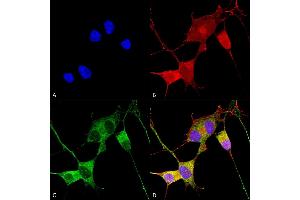 Immunocytochemistry/Immunofluorescence analysis using Mouse Anti-Ataxin 1 Monoclonal Antibody, Clone S76-8 (ABIN1741199). (Ataxin 1 antibody  (AA 164-197) (Atto 488))