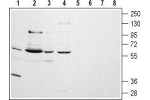 Western blot analysis of rat lung (lanes 1 and 5) and brain (lanes 2 and 6) membranes, human A-875 melanoma (lanes 3 and 7) and human MALM-3M malignant melanoma (lanes 4 and 8) cell lysates: - 1-4. (CHRM5 antibody  (Extracellular, N-Term))