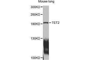 Western blot analysis of extracts of mouse lung, using TET2 antibody (ABIN1875061) at 1:1000 dilution. (TET2 antibody)