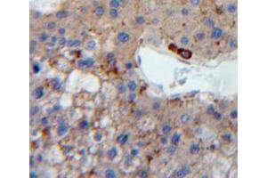 IHC-P analysis of liver tissue, with DAB staining. (LDLR antibody  (AA 263-509))