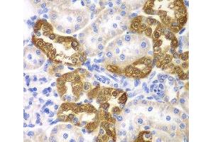 Immunohistochemistry of paraffin-embedded Rat kidney using CD151 Polyclonal Antibody at dilution of 1:200 (40x lens). (CD151 antibody)