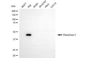 Western blotting analysis using paired box 5 antibody (ABIN7799724).