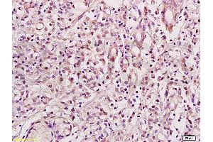 Formalin-fixed and paraffin embedded mouse brain labeled with Anti-NRSF/REST Polyclonal Antibody, Unconjugated (ABIN747683) at 1:200 followed by conjugation to the secondary antibody and DAB staining.