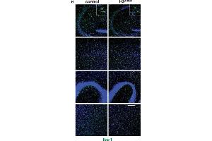 Immunofluorescence (Paraffin-embedded Sections) (IF (p)) image for anti-Ionized Calcium-binding Adapter Molecule 1 (IBA1) (C-Term) antibody (ABIN2857032)