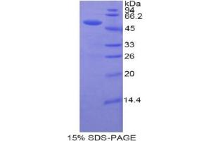 SDS-PAGE analysis of Human UPRT Protein. (Uracil Phosphoribosyltransferase (UPP) Protein)