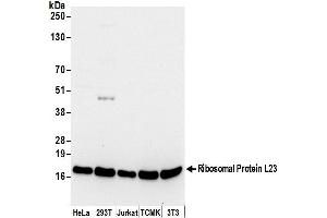 anti-Ribosomal Protein L23 (RPL23) (AA 50-100) antibody
