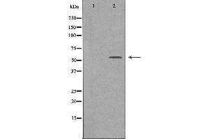Western blot analysis of extracts from LOVO cells, using SFRS4 antibody. (SRSF4 antibody  (Internal Region))
