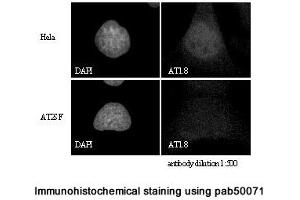 Image no. 2 for anti-Ataxia Telangiectasia Mutated (ATM) (C-Term) antibody (ABIN363380) (ATM antibody  (C-Term))