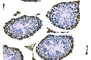 IHC analysis of RRS1 using anti-RRS1 antibody (ABIN7601344). (RRS1 antibody  (AA 33-266))