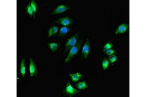 Immunofluorescent analysis of A549 cells using ABIN7169532 at dilution of 1:100 and Alexa Fluor 488-congugated AffiniPure Goat Anti-Rabbit IgG(H+L) (DHRS3 antibody  (AA 30-169))