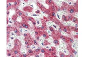 Immunohistochemistry (IHC) image for anti-Hydroxysteroid (11-Beta) Dehydrogenase 1 (HSD11B1) (N-Term) antibody (ABIN2773867) (HSD11B1 antibody  (N-Term))