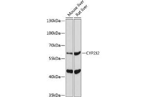 Western blot analysis of extracts of various cell lines, using CYP2J2 Antibody (ABIN6134306, ABIN6139339, ABIN6139340 and ABIN6221491) at 1:1000 dilution. (CYP2J2 antibody  (AA 200-300))