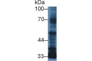 Western blot analysis of Human MCF7 cell lysate, using Human TGFb3 Antibody (3 µg/ml) and HRP-conjugated Goat Anti-Mouse antibody (