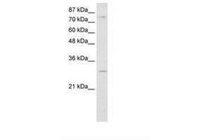 Image no. 3 for anti-RNA Binding Motif Protein 28 (RBM28) (AA 651-700) antibody (ABIN6736238) (RBM28 antibody  (AA 651-700))