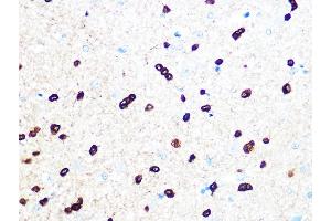 Immunohistochemistry of paraffin-embedded rat brain using TPPP/p25 Rabbit mAb (ABIN7271031) at dilution of 1:100 (40x lens). (Tppp antibody)