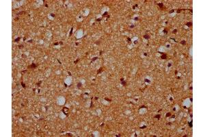 IHC image of ABIN7163112 diluted at 1:200 and staining in paraffin-embedded human brain tissue performed on a Leica BondTM system. (CDS2 antibody  (AA 354-445))