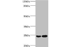 Western blot All lanes: RAN antibody at 2 μg/mL Lane 1: Hela whole cell lysate Lane 2: Jurkat whole cell lysate Secondary Goat polyclonal to rabbit IgG at 1/10000 dilution Predicted band size: 24 kDa Observed band size: 24 kDa (RAN antibody  (AA 1-216))