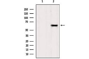 Western blot analysis of extracts from Sp2/0, using TCTN1 Antibody. (TCTN1 antibody  (N-Term))