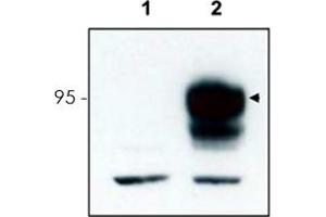 Western blot using Ntrk3 polyclonal antibody  to detect over-expressed Ntrk3 in HEK293 cells (Lane 2, arrowhead). (NTRK3 antibody  (C-Term))