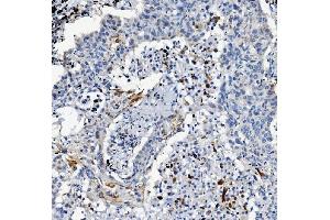 IHC analysis of ATG7 using anti-ATG7 antibody (ABIN7603109). (ATG7 antibody  (N-Term))
