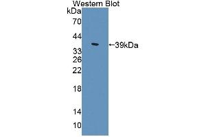 Detection of Recombinant ALDH1A1, Mouse using Polyclonal Antibody to Aldehyde Dehydrogenase 1 Family, Member A1 (ALDH1A1) (ALDH1A1 antibody  (AA 1-326))