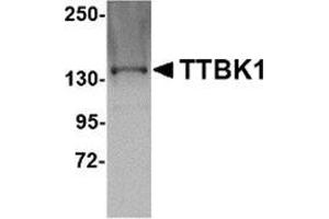 Western blot analysis of TTBK1 in Jurkat lysate with this product at 1 μg/ml.