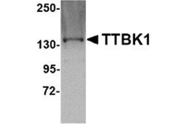 TTBK1 antibody  (C-Term)