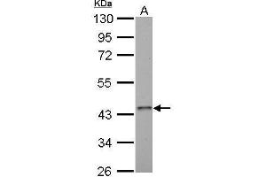 WB Image beta 2 Adrenergic Receptor antibody [C2C3], C-term detects ADRB2 protein by Western blot analysis. (beta 2 Adrenergic Receptor antibody  (C-Term))