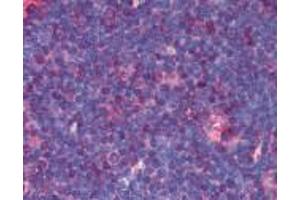 Human Thymus (formalin-fixed, paraffin-embedded) stained with TNFRSF8 antibody LS-B1865 at 5 ug/ml followed by biotinylated anti-mouse IgG secondary antibody LS-D2, alkaline phosphatase-streptavidin and chromogen. (TNFRSF8 antibody)