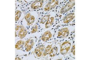 Immunohistochemistry of paraffin-embedded human stomach using SERPINB5 Antibody  at dilution of 1:200 (40x lens). (SERPINB5 antibody  (AA 21-189))