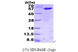 SDS-PAGE (SDS) image for Myeloid Cell Nuclear Differentiation Antigen (MNDA) (AA 1-407) protein (His tag) (ABIN668050) (MNDA Protein (AA 1-407) (His tag))