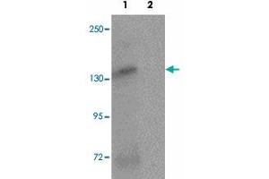 Western blot analysis of ATP2C2 in NIH/3T3 cell lysate with ATP2C2 polyclonal antibody  at 1 ug/mL in (1) the absence and (2) the presence of blocking peptide.