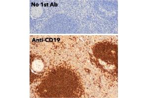 Immunohistochemistry (IHC) image for anti-CD19 Molecule (CD19) (C-Term) antibody (ABIN6254219) (CD19 antibody  (C-Term))