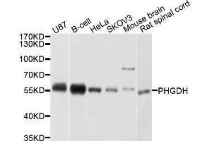 Western blot analysis of extracts of various cell lines, using PHGDH antibody. (PHGDH antibody  (AA 264-533))