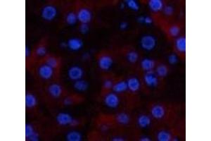 Immunofluorescence analysis of Human stomach tissue using CD23 Monoclonal Antibody at dilution of 1:200. (FCER2 antibody)