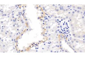 Detection of MMP3 in Human Kidney Tissue using Polyclonal Antibody to Matrix Metalloproteinase 3 (MMP3) (MMP3 antibody  (AA 247-370))
