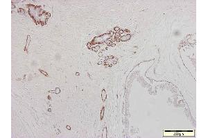 Image no. 1 for anti-Actin, alpha 2, Smooth Muscle, Aorta (ACTA2) antibody (ABIN335372) (Smooth Muscle Actin antibody)
