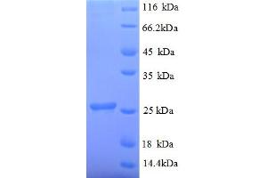 SDS-PAGE (SDS) image for Ubiquitin-Conjugating Enzyme E2K (UBE2K) (AA 2-200) protein (His tag) (ABIN4975966)