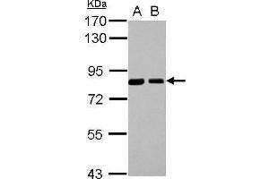WB Image Sample (30 ug of whole cell lysate) A: H1299 B: HCT116 7. (SNX9 antibody)
