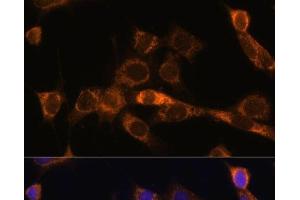 Immunofluorescence analysis of NIH/3T3 cells using FoxO3a Polyclonal Antibody at dilution of 1:100. (FOXO3 antibody)