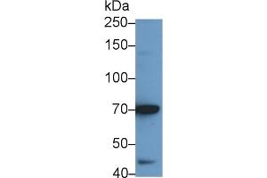 Detection of IL12Rb2 in BXPC3 cell lysate using Polyclonal Antibody to Interleukin 12 Receptor Beta 2 (IL12Rb2)
