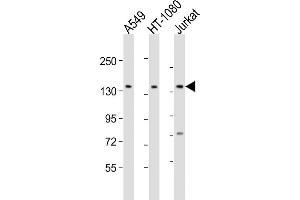 All lanes : Anti-FMN1 Antibody (Center) at 1:2000 dilution Lane 1: A549 whole cell lysate Lane 2: HT-1080 whole cell lysate Lane 3: Jurkat whole cell lysate Lysates/proteins at 20 μg per lane.