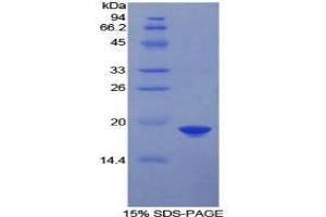 SDS-PAGE analysis of Human FDFT1 Protein.