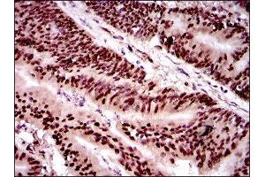 Immunohistochemistry (IHC) image for anti-Twist Homolog 1 (Drosophila) (TWIST1) (AA 9-74) antibody (ABIN1842915) (TWIST1 antibody  (AA 9-74))