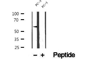 ETV5 antibody  (Internal Region)